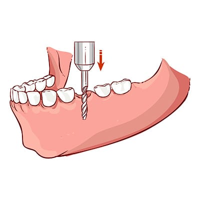 Enter a modern place and meet a good dentist glen waverley