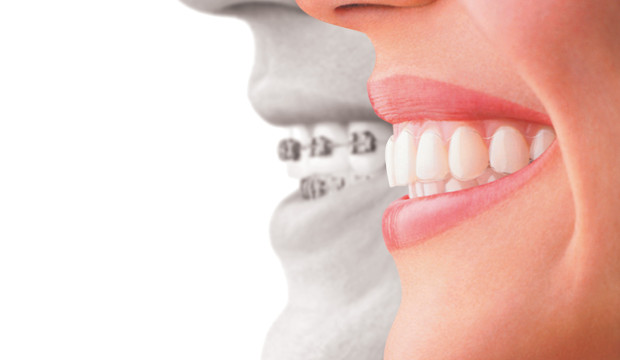 How will you be benefited from a regular dental visit?